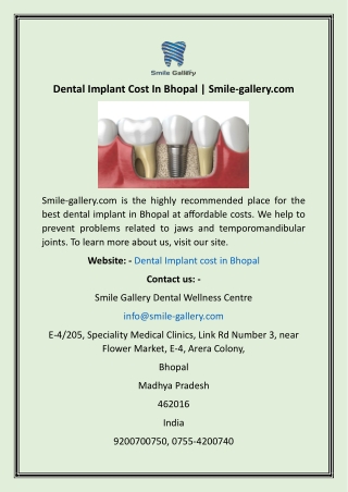 Dental Implant Cost In Bhopal  Smile-gallery
