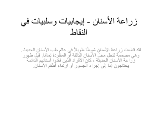 زراعة الأسنان - إيجابيات وسلبيات في النقاط