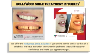 Hollywood Smile Treatment in Turkey