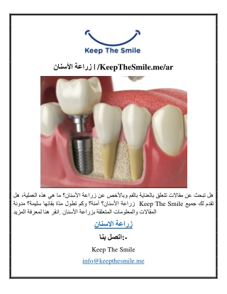 زراعة الأسنان KeepTheSmile.me ar