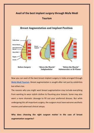 Avail of the best implant surgery through Mufa Medi Tourism