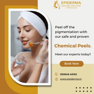 Peel off the pigmentation with chemical peels -  Epiderma Clinic