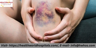 5 facts about hemophilia you may not know  HealthWorldHospitals