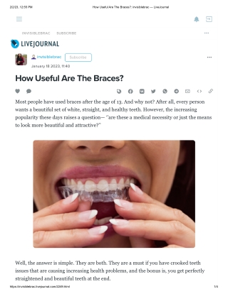 How Useful Are The Braces - invisiblebraceskolkata