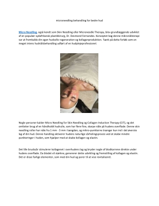 microneedling behandling for bedre hud