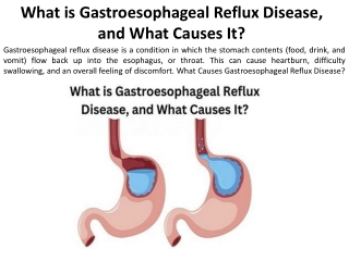 What exactly causes gastroesophageal reflux disease