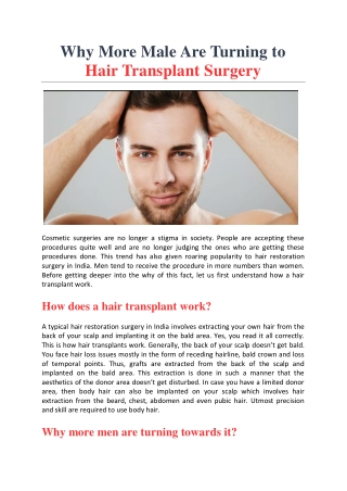 Why More Male Are Turning to Hair Transplant Surgery