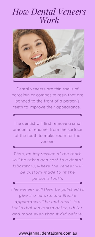 how dental veneers work