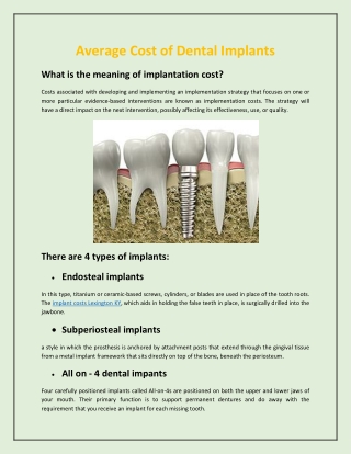 Average Cost of Dental Implants