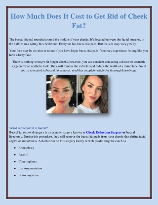 How Much Does It Cost to Get Rid of Cheek Fat?