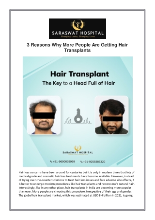 3 Reasons Why More People Are Getting Hair Transplants