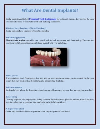 What Are Dental Implants?