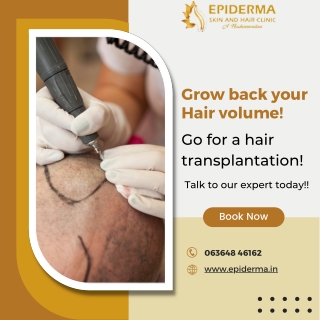 Grow back your Hair volume - Best Hair Clinic in Jayanagar - Epiderma Clinic