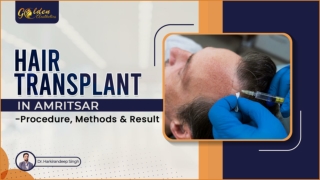 Hair Transplant in Amritsar - Procedure, Methods & Result