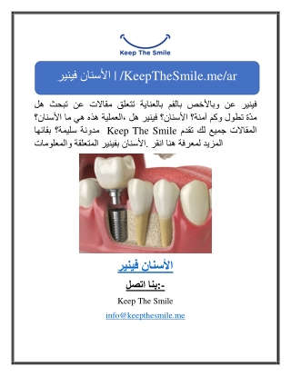 فينير الأسنان | /KeepTheSmile.me/ar