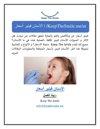 أسعار فينير الأسنان | /KeepTheSmile.me/ar