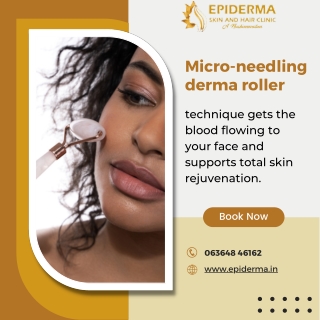 Microneedling for Acne Scars - Best Skin Clinic in Jayanagar - Epiderma Clinic