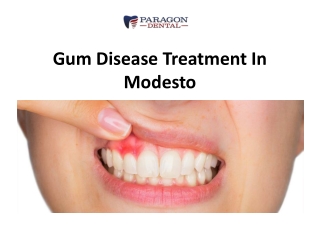 Gum Disease Treatment In Modesto