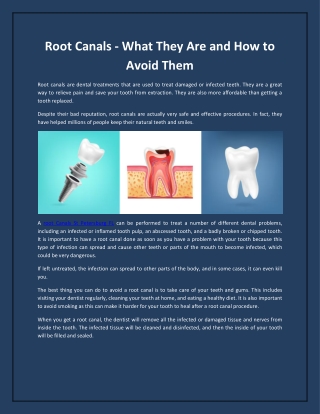 Root Canals - What They Are and How to Avoid Them