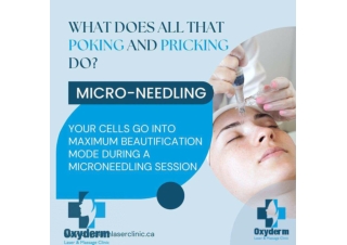 Microneedling services in Edmonton, Alberta | Oxyderm laser clinic