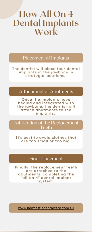 How All On 4 Dental Implants Work