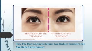 How the best aesthetic clinics can reduce excessive fat and dark circle issues?