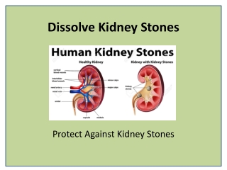 Treating Kidney Stones Naturally with Stonil Capsule