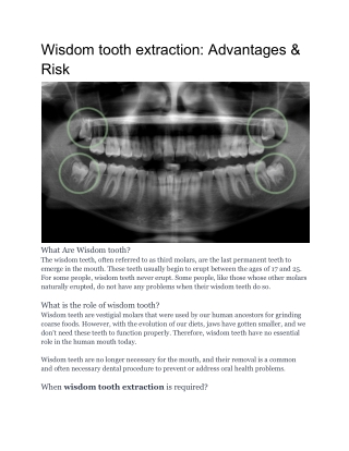 Wisdom tooth extraction_ Advantages, Precautions, Risk