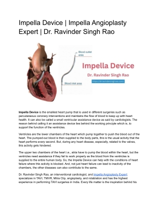 Impella Device - Impella Angioplasty Expert | Dr. Ravinder Singh Rao