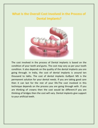 What Is the Overall Cost Involved in the Process of Dental Implants?
