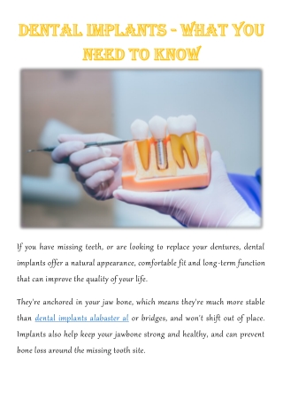 Dental Implants - What You Need to Know