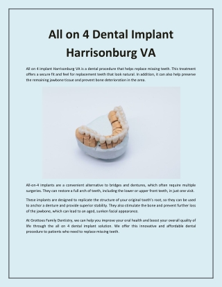 All on 4 Dental Implant Harrisonburg VA