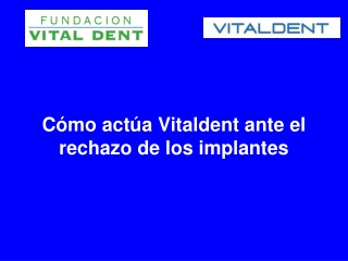 Como actua Vitaldent ante el rechazo de los implantes