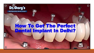 How To Get The Perfect Dental Implant In Delhi?