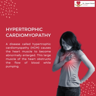 Hypertrophic Cardiomyopathy by Best Heart Specialist in Bangalore | Dr. Ameet Os