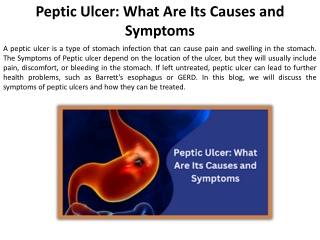 What Signs and Symptoms Indicate a Peptic Ulcer?