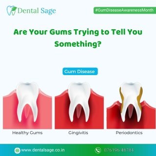 Are Your Gums Trying to Tell Something | Dental Clinic Yelahanka | Dental sage