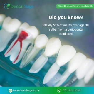 Know about periodontal Disease | Best Dentist in Yelahanka | Dental Sage