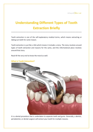 Understanding Different Types of Tooth Extraction Briefly
