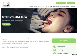 A Comprehensive Guide to Getting a Broken Tooth Filling Done In Auckland