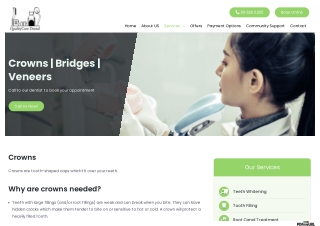 Where to Find Affordable Dental Tooth Bridges in Auckland