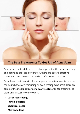 The Best Treatments To Get Rid of Acne Scars