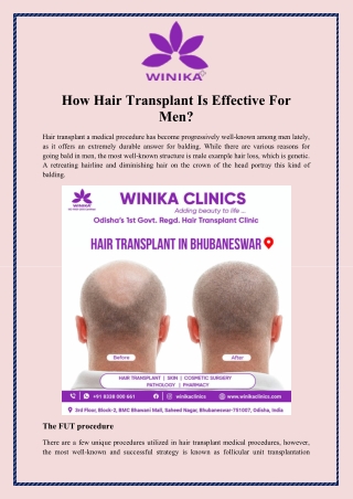 How Hair Transplant Is Effective For Men
