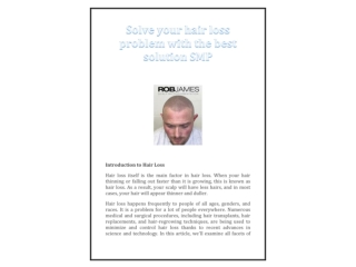 Solve your hair loss problem with the best solution SMP