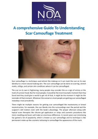 A comprehensive guide to understanding scar camouflage treatment