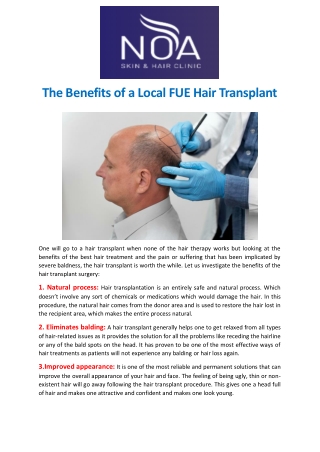 The Benefits of a Local FUE Hair Transplant