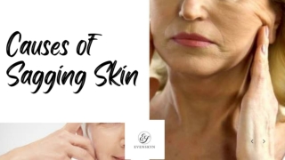 Causes of Sagging Skin