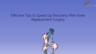 Effective Tips to Speed Up Recovery After Knee Replacement Surgery