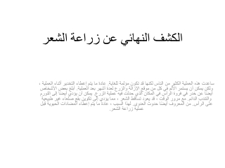 الكشف النهائي عن زراعة الشعر