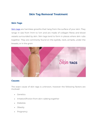 Skin Tag Removal Treatment